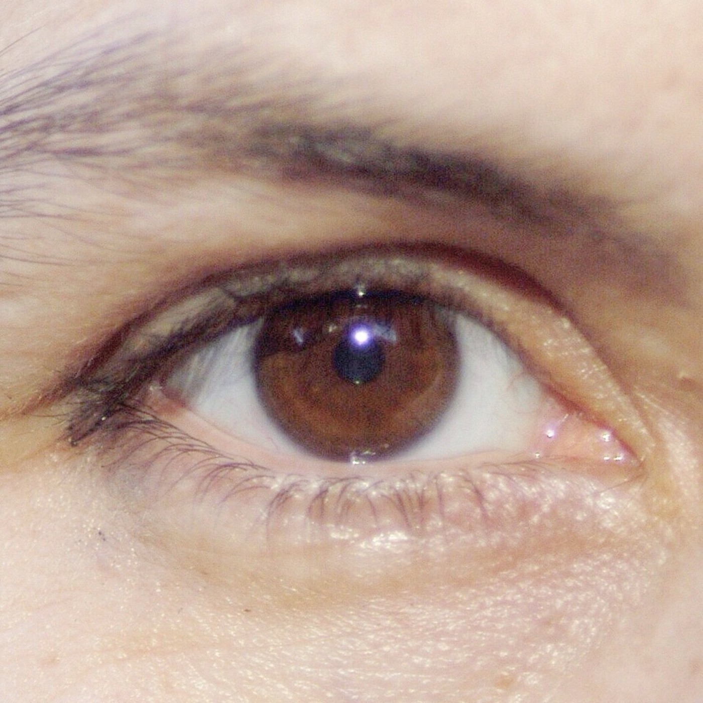 Ojo de Pez