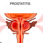 Prostatitis, Orquitis y Uretritis by Enric Rosas