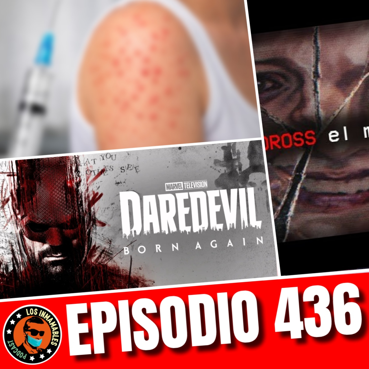 Daredevil Born Again T2, sarampión en México y la polémica de Dross