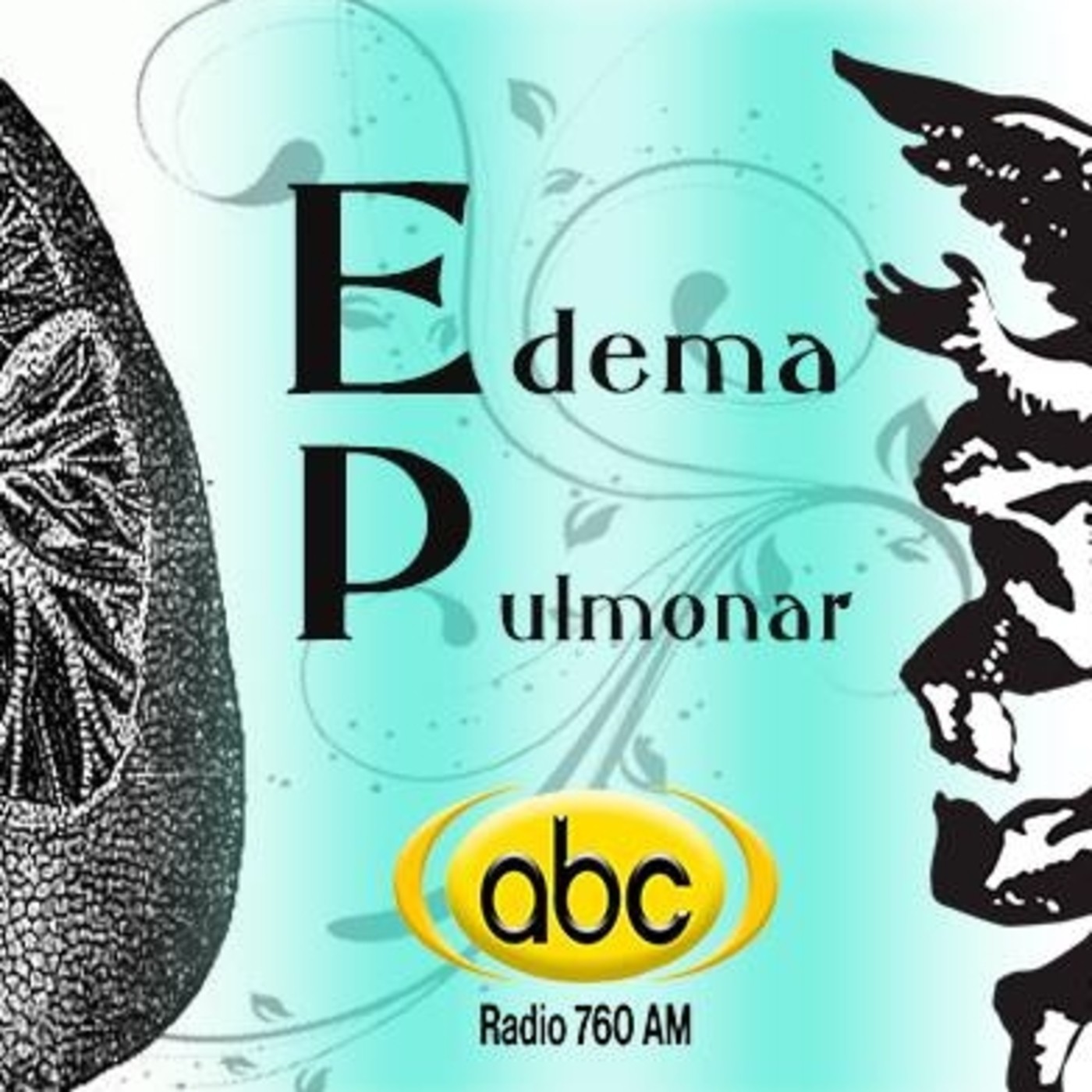 El Ángel de tu Salud - EDEMA PULMONAR episode artwork
