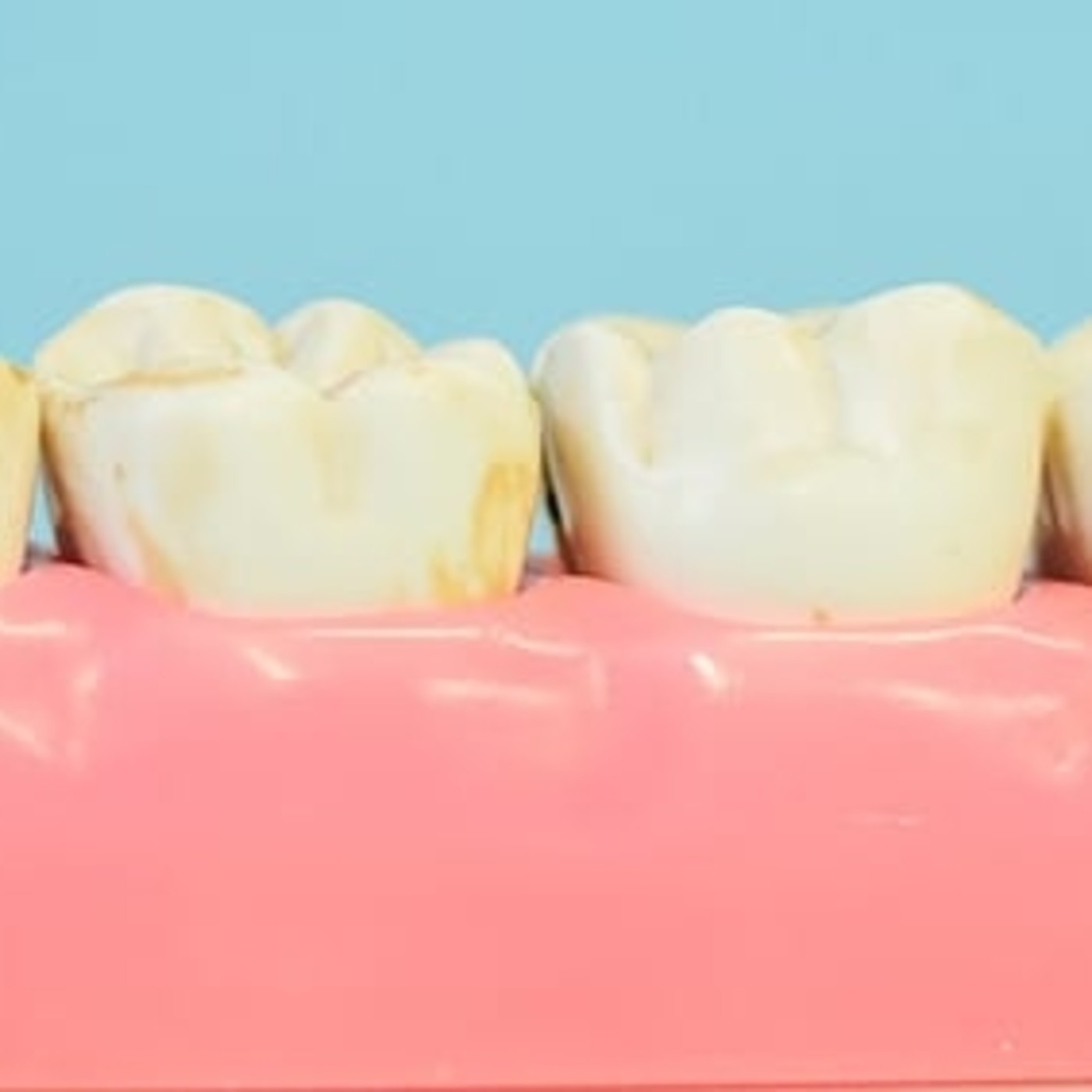 Salud Bucodental