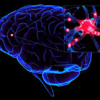 Neurociencias del Dolor. De tu peor enemigo a tu mejor aliado