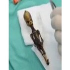La verdad sobre el 'extraterrestre de Atacama' y el caso de Roswell