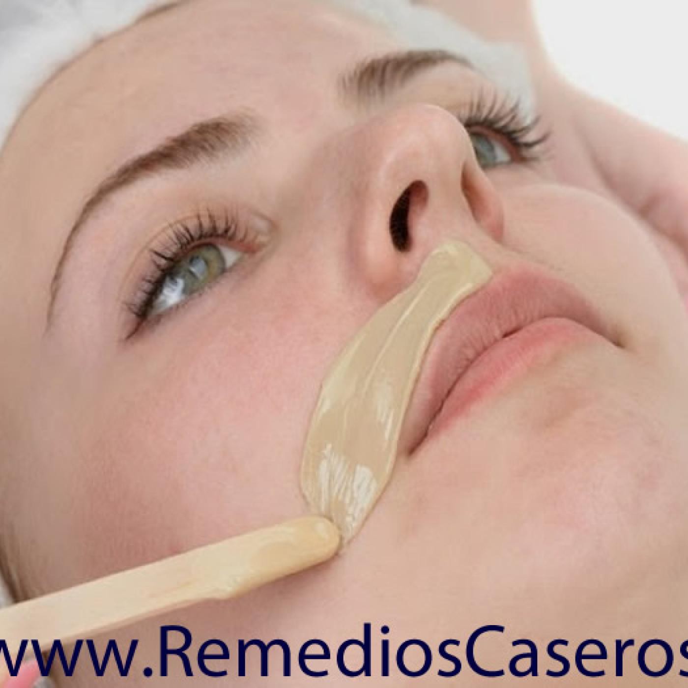 Remedios Caseros