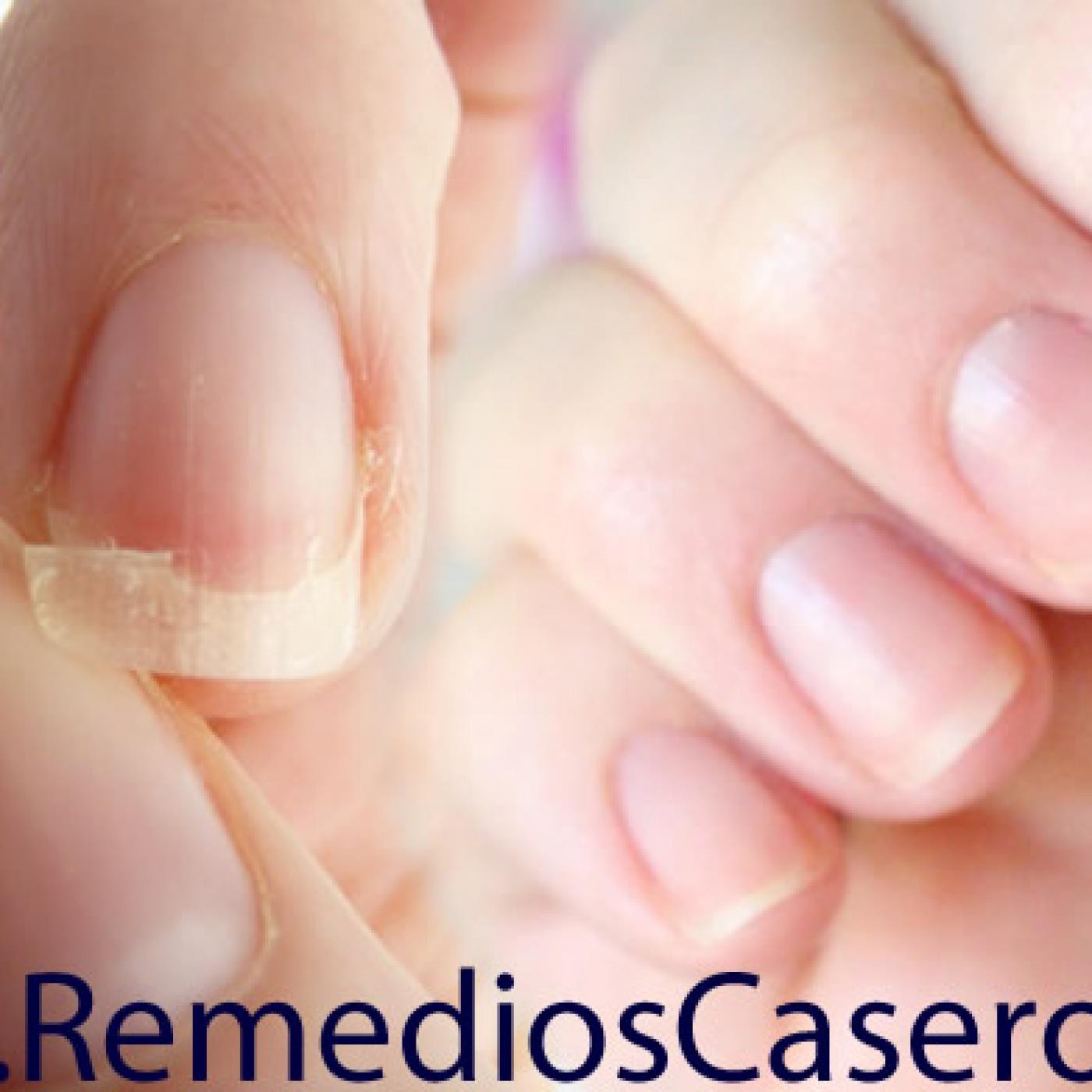 Remedios Caseros
