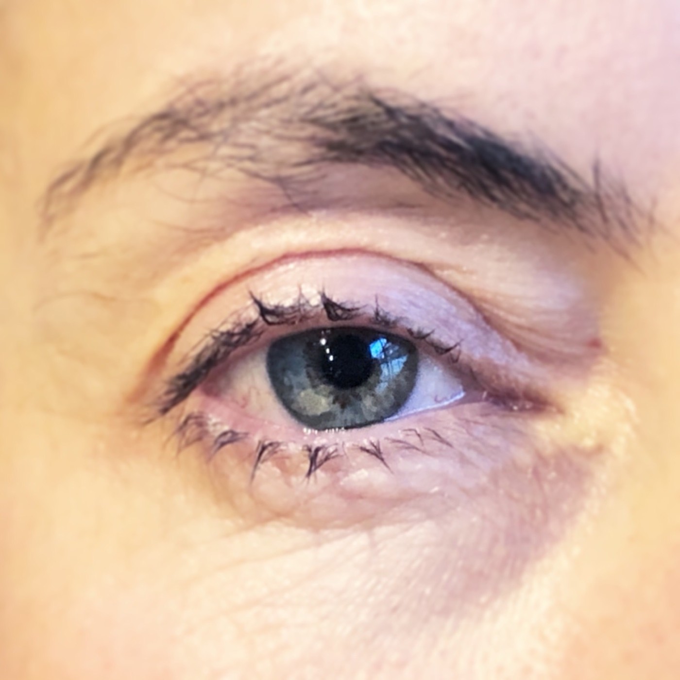 Ojo de Pez