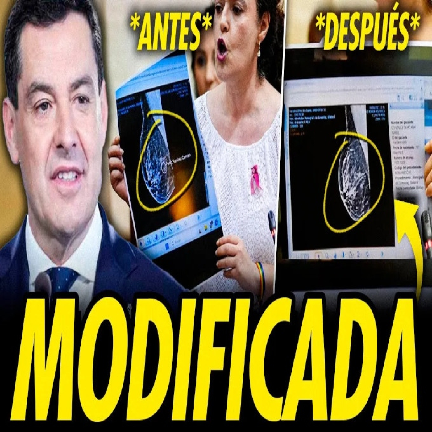 MORENO BONILLA KO: PRUEBAS DE LAS MAMOGRAFÍAS MODIFICADAS Y CAMPAÑA SUCIA DEL PP CONTRA AMAMA