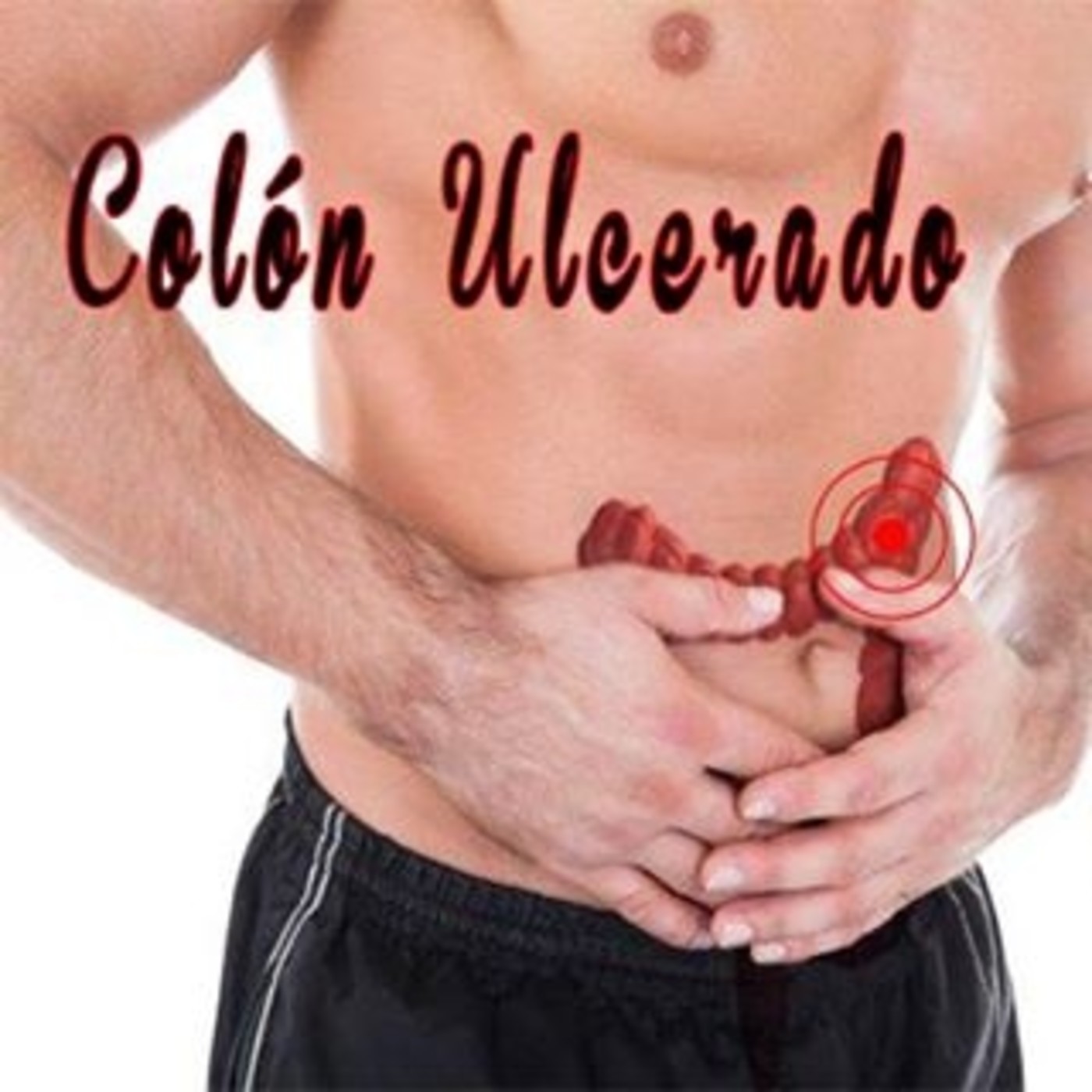 El Ángel de tu Salud - COLON ULCERADO episode artwork