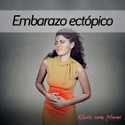 99. Embarazo ectópico