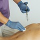 Fisioterapia y artrosis