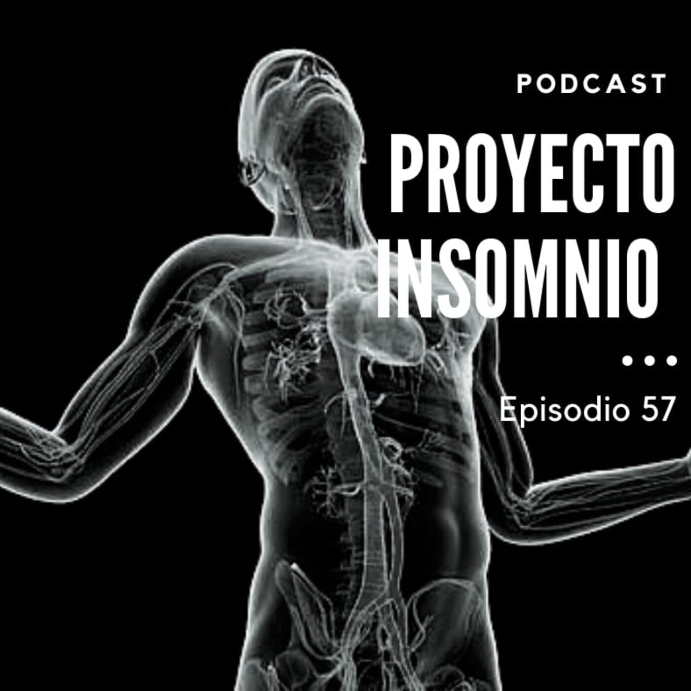 Proyecto Insomnio