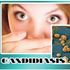 EL ÁNGEL DE TU SALUD- Rodrigo Mondragón - CANDIDIASIS