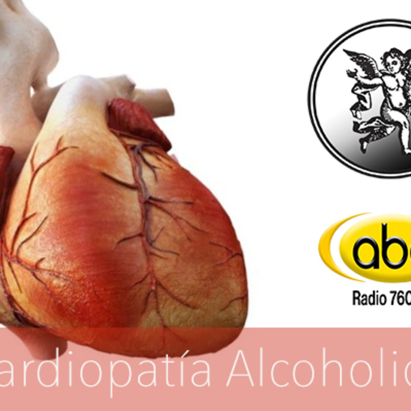El Angel de tu Salud - MIOCARDIOPATÍA ALCOHOLICA episode artwork