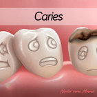 60. Caries