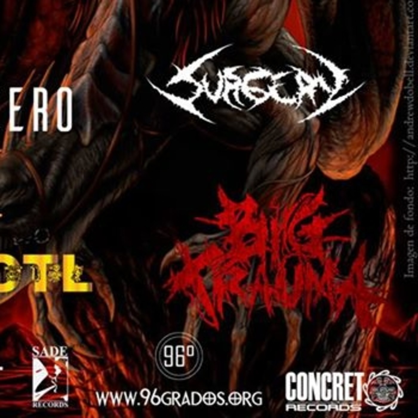 Entrevista Big Trauma episode artwork