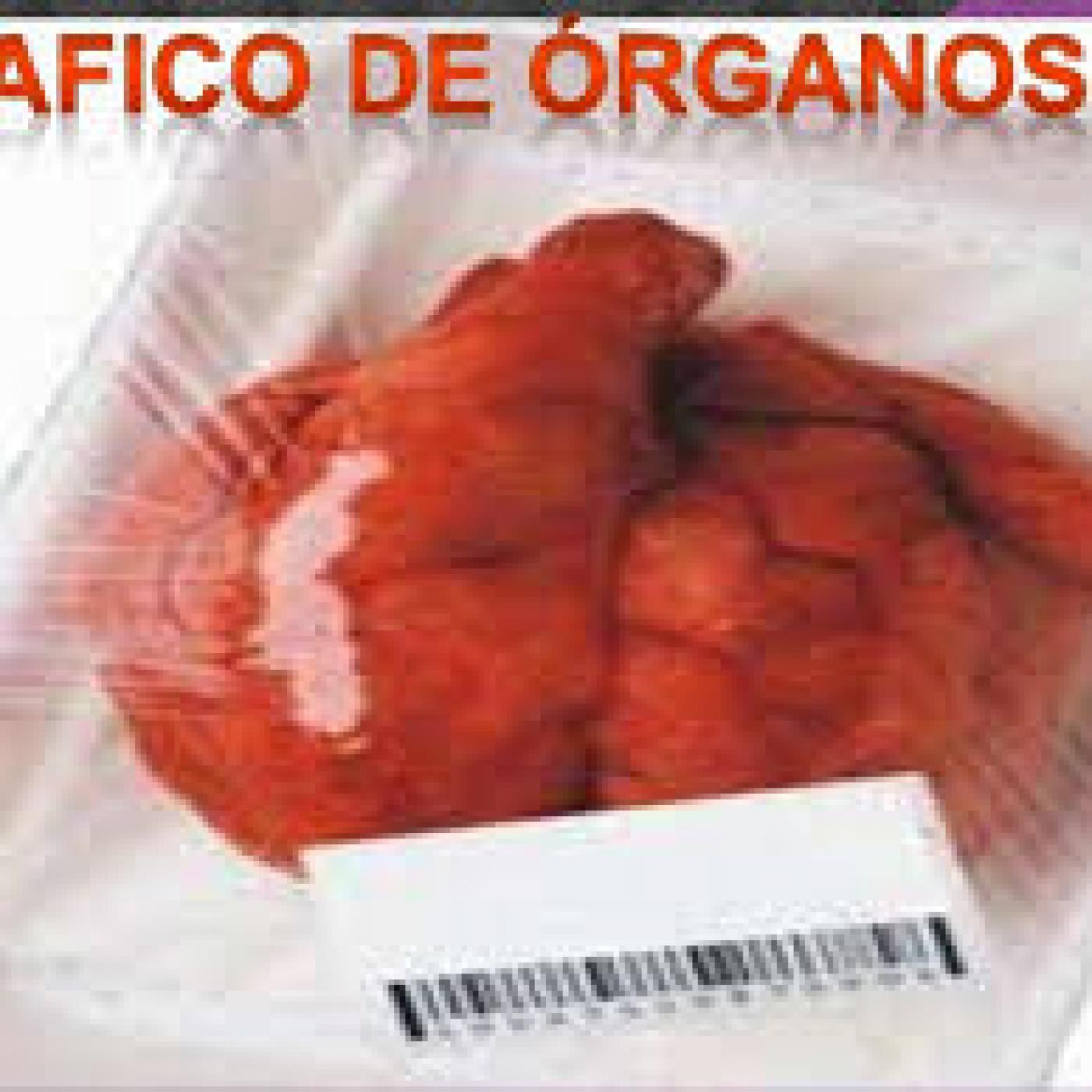 El tráfico de órganos
