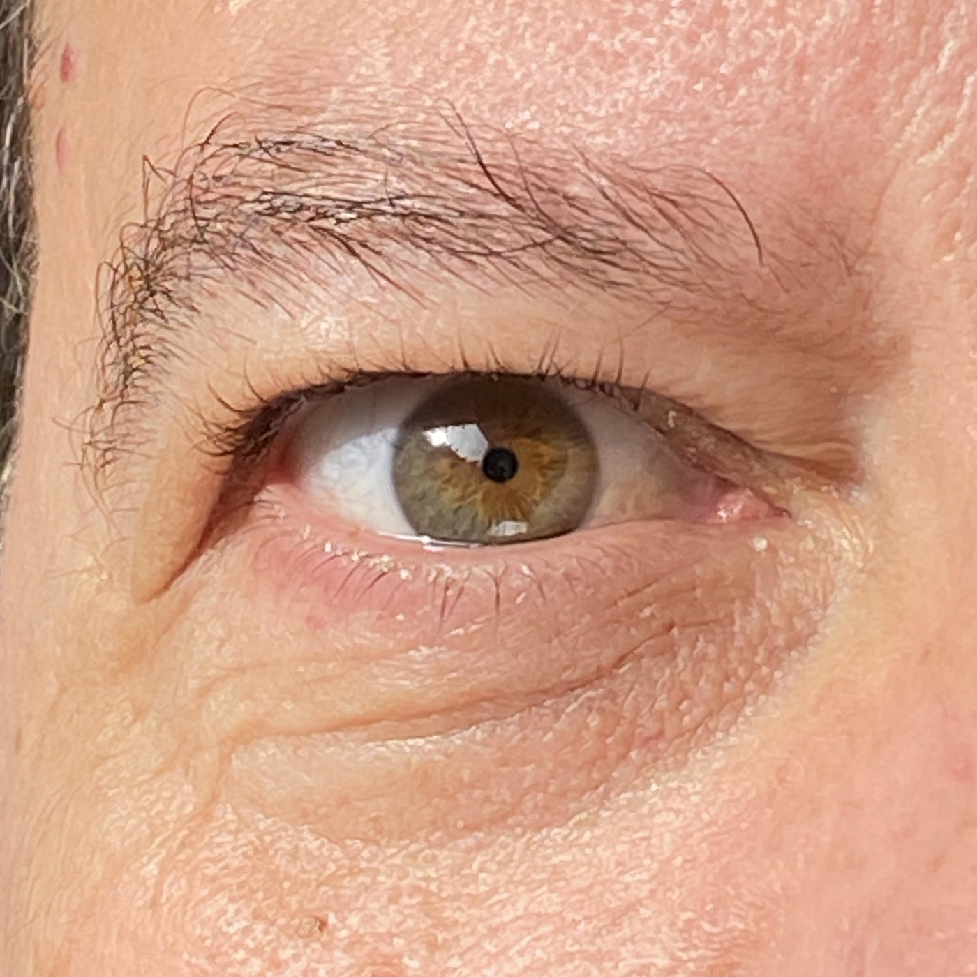 Ojo de Pez