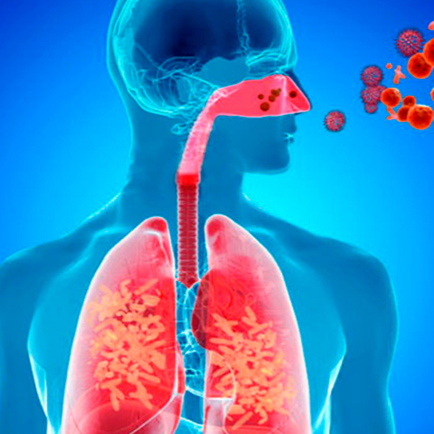 Conoce todo sobre las infecciones respiratorias agudas