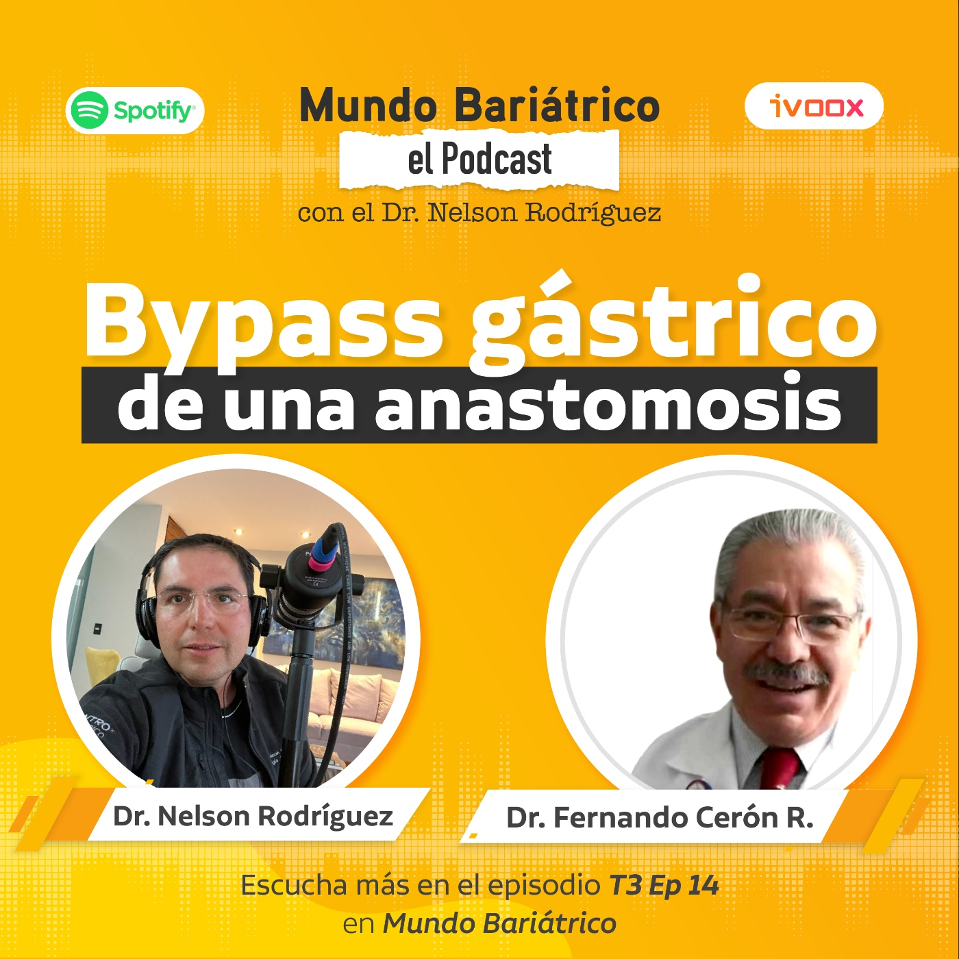Mundo Bariátrico "Bypass gástrico de una anastomósis" T3 EP 14 episode artwork