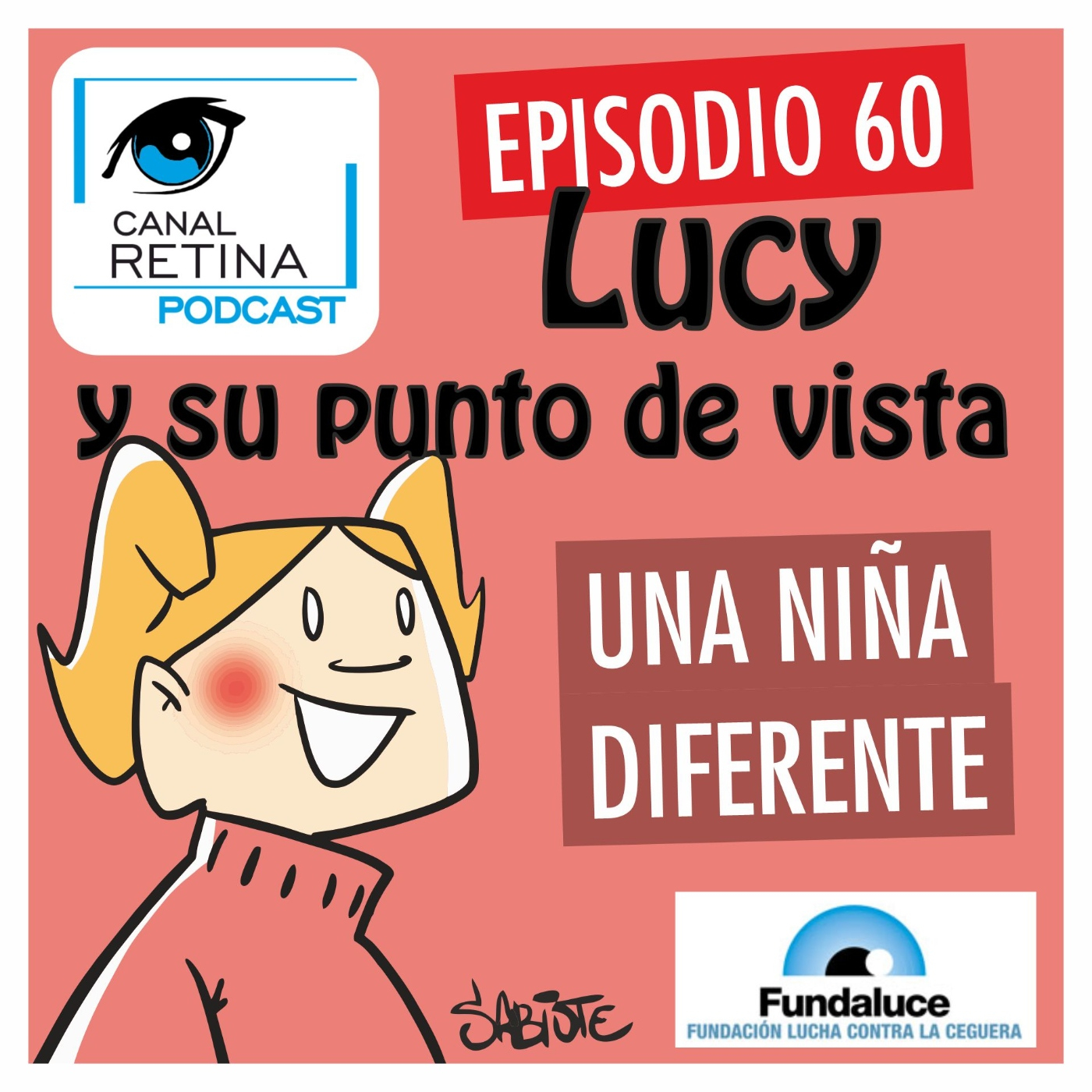 Canal Retina