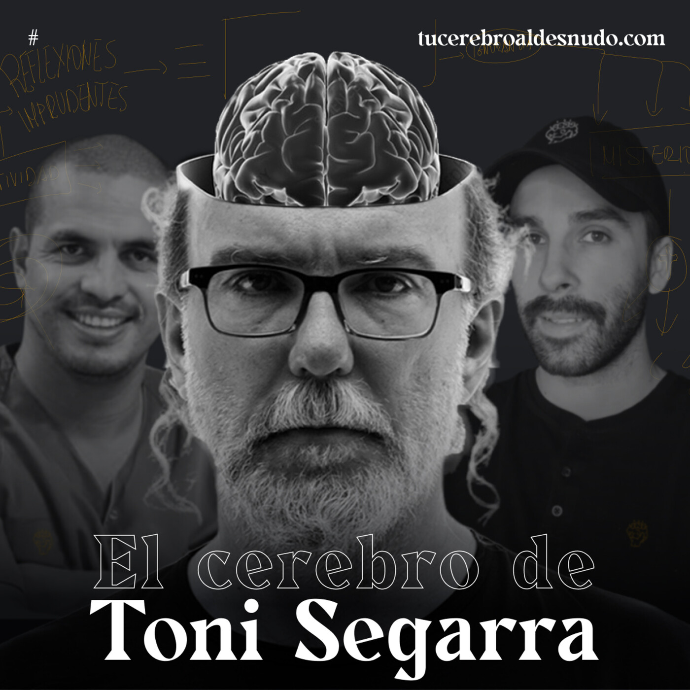 Cerebro Injodible®