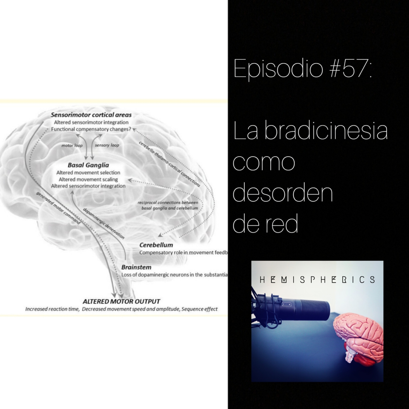 Hemispherics