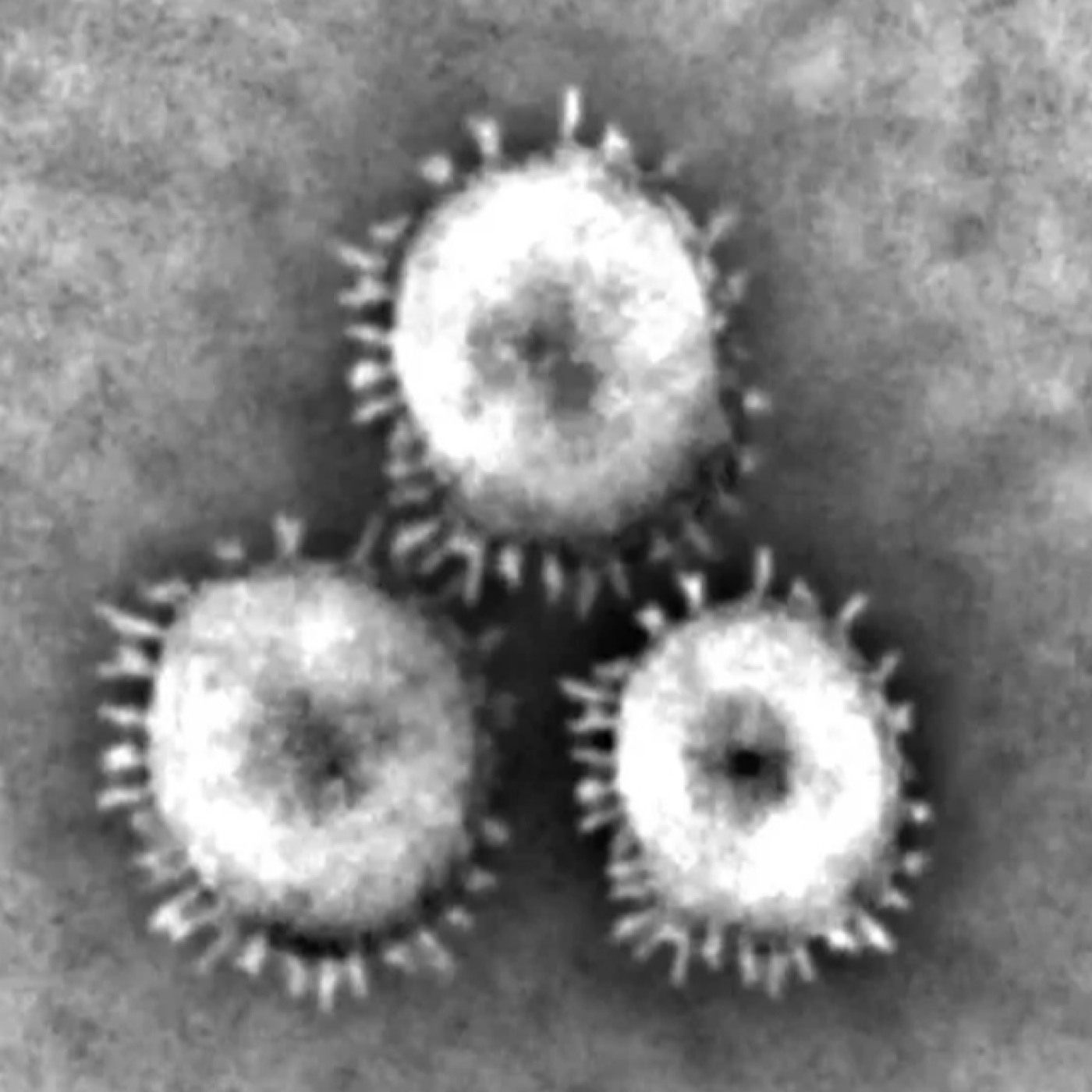 Horizonte: ¿Cuál es el verdadero origen del Coronavirus?