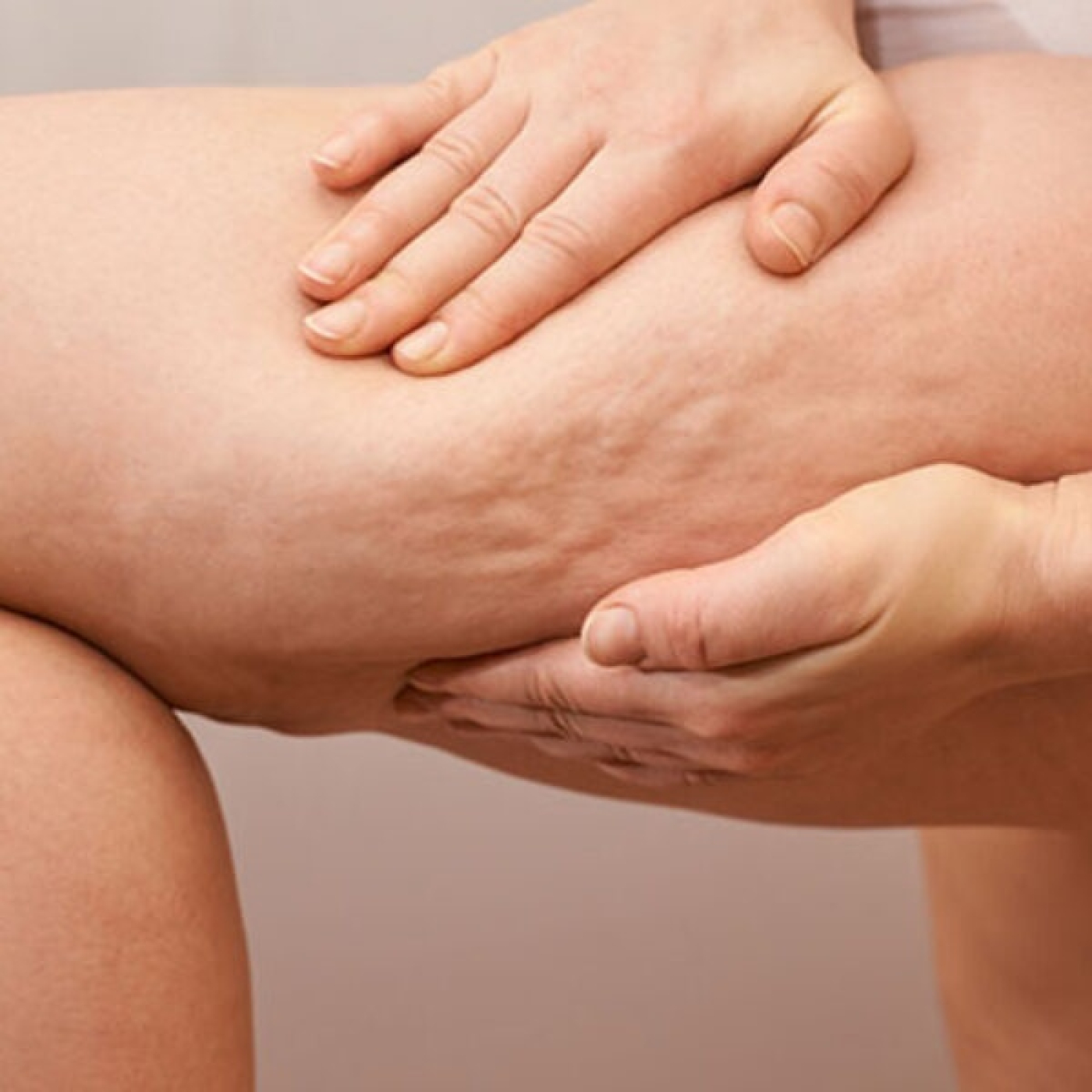 TIPOS DE CELULITIS Y SUS SOLUCIONES, con Dra. Helga Rivera