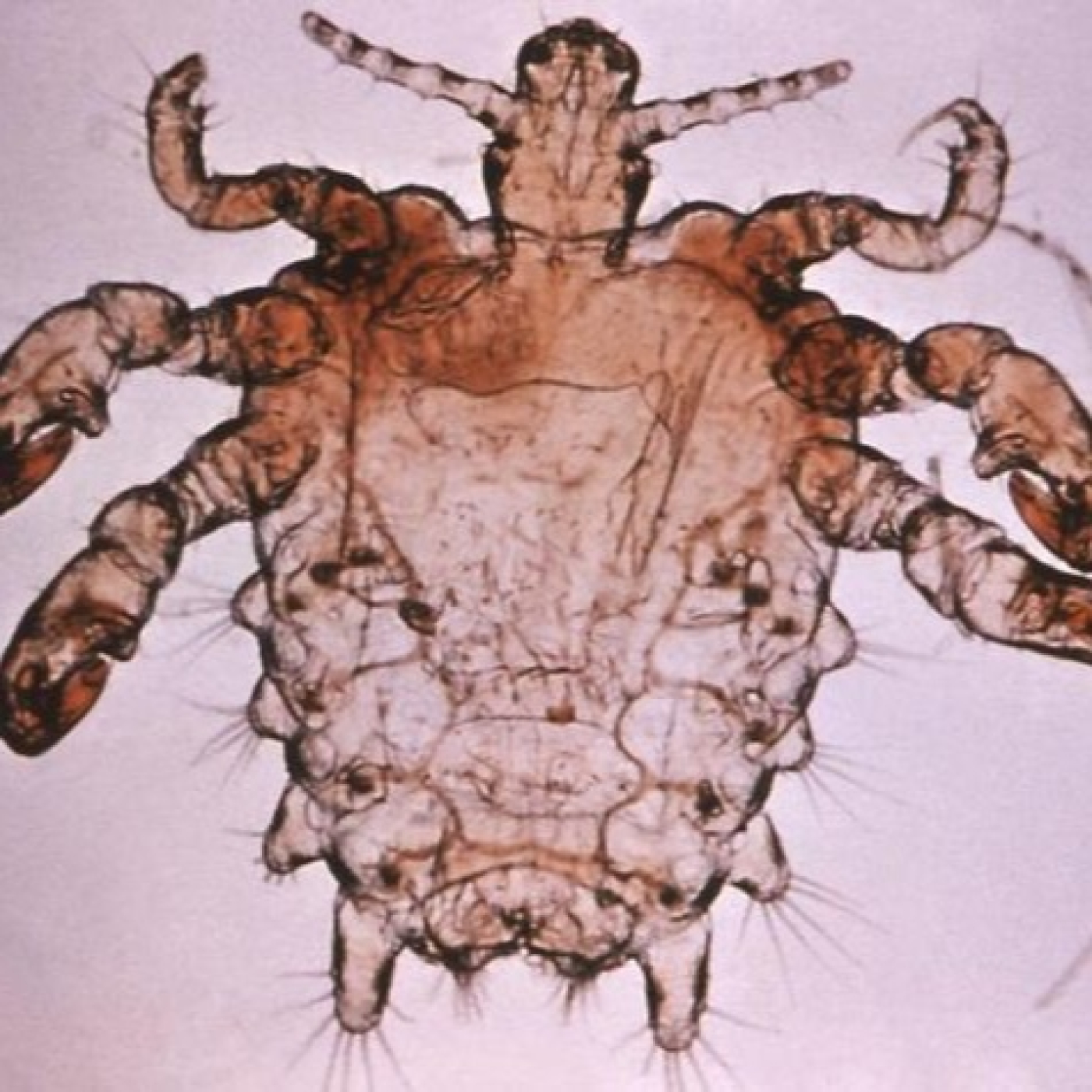 EHC 35T9- L'insòlit perill d'extinció de les lladelles i el pèl púbic episode artwork