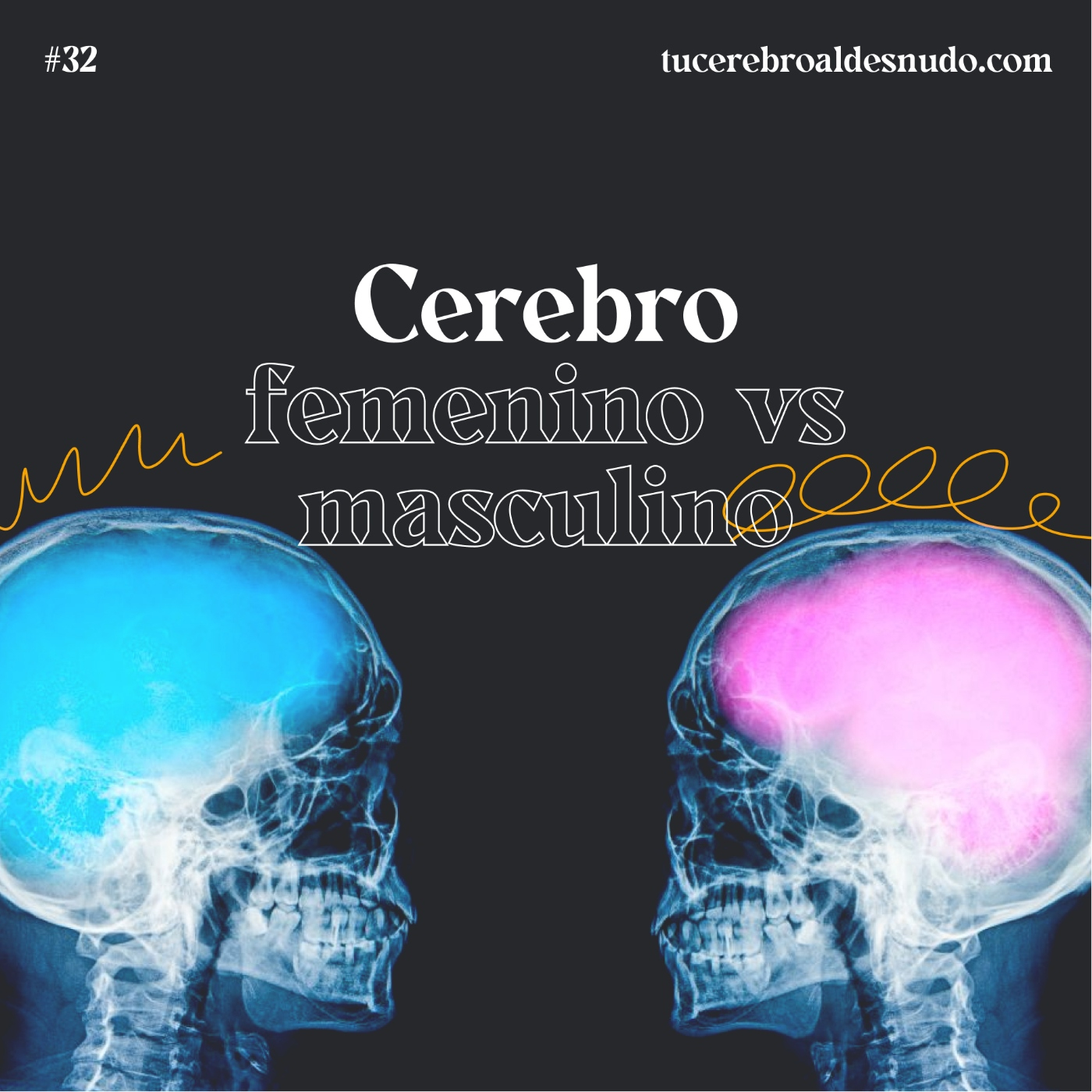 Cerebro Injodible®