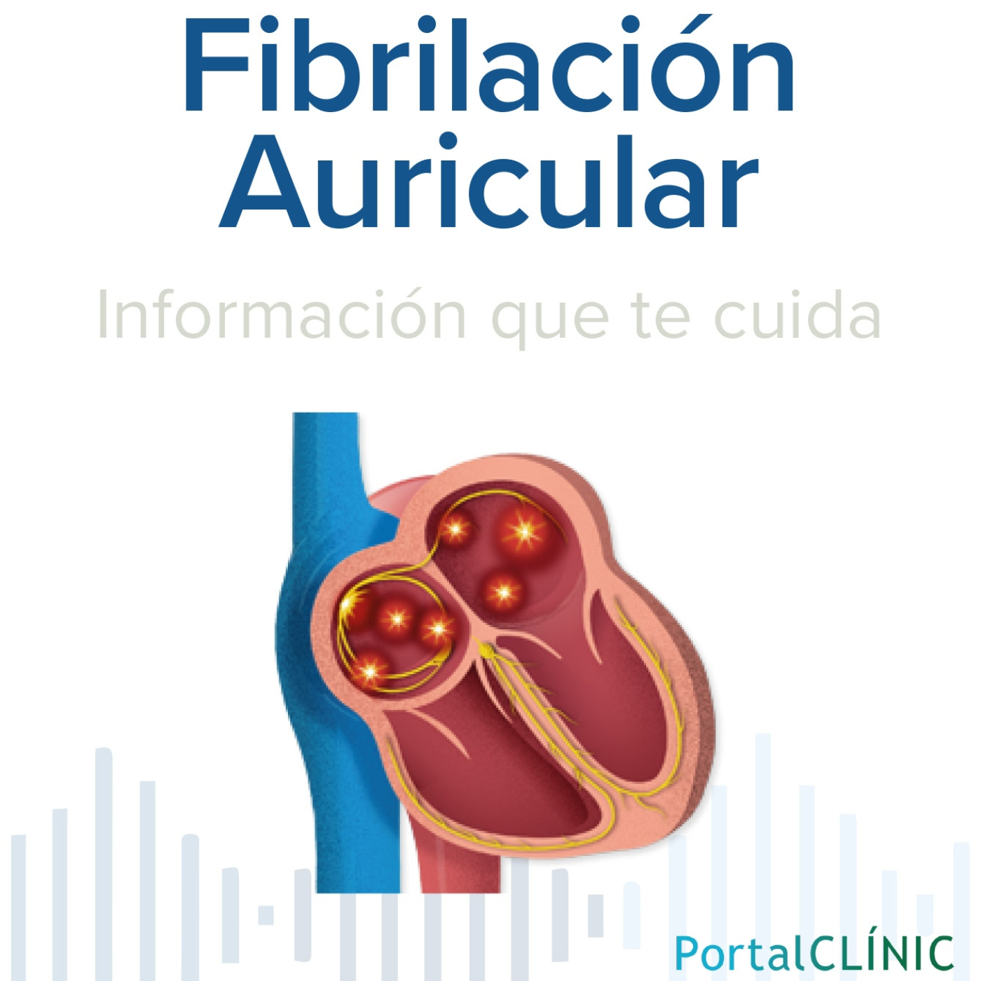 'Alteración del ritmo cardíaco' | Fibrilación auricular | Podcast episode artwork