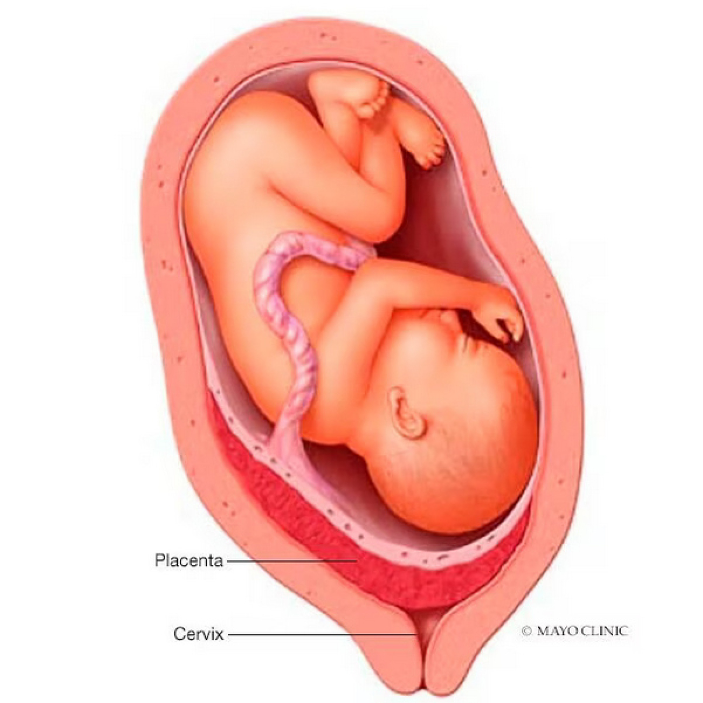 ¿Presentas sangrado vaginal sin dolor en el segundo trimestre de embarazo?