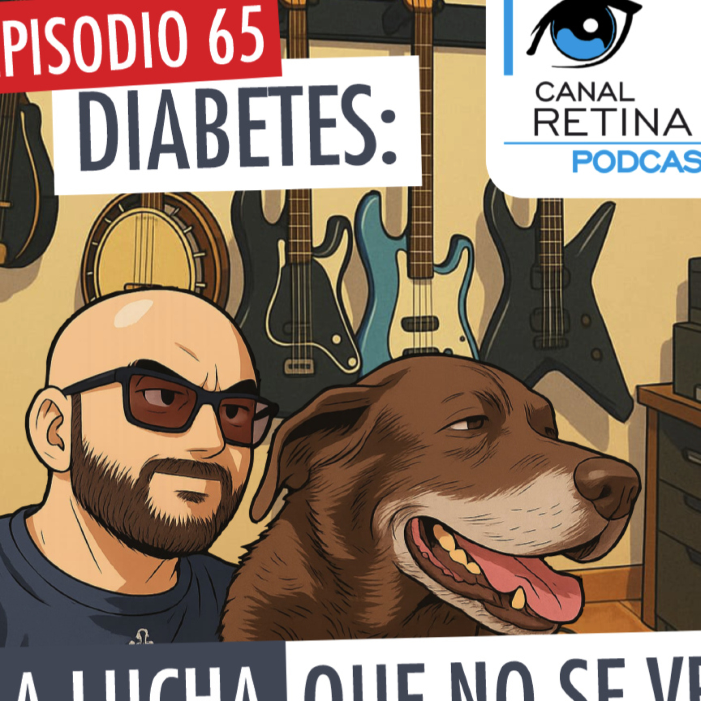 Canal Retina