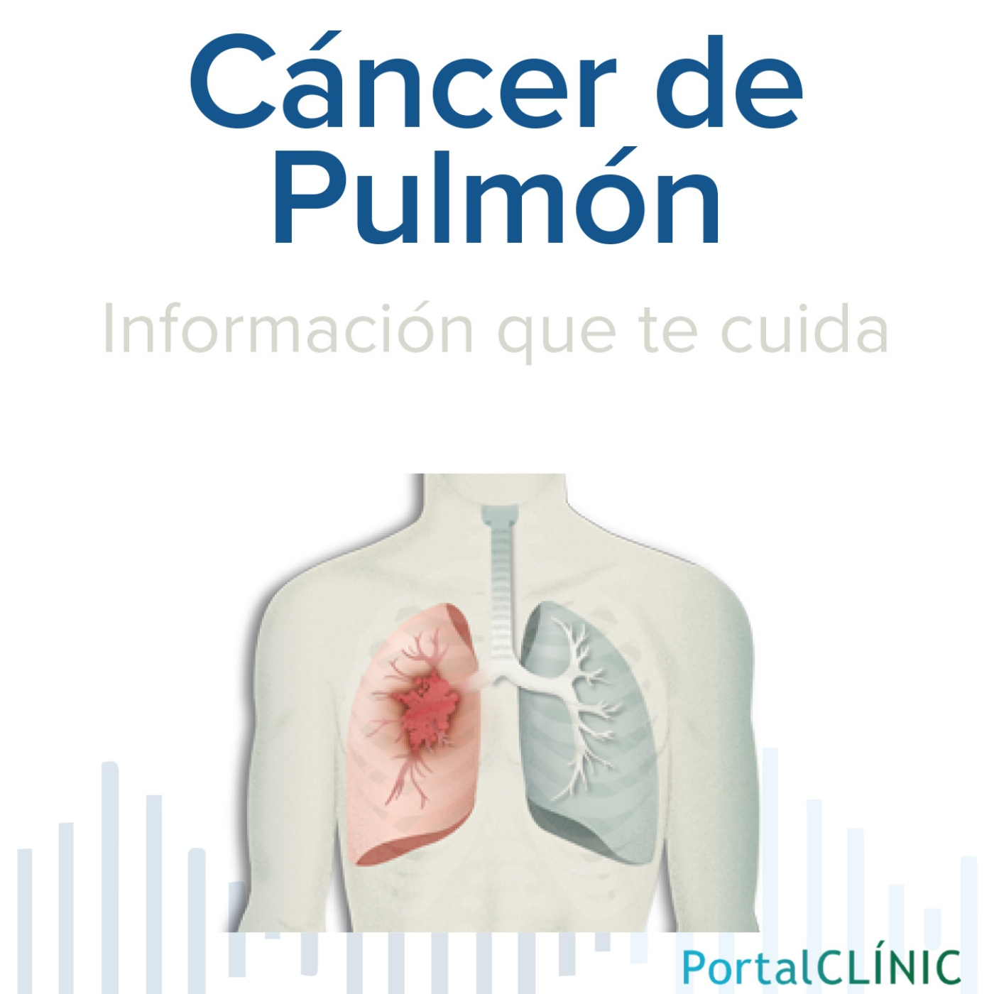 'El tabaco es la principal causa del cáncer de pulmón' | Cáncer de pulmón | Podcast episode artwork