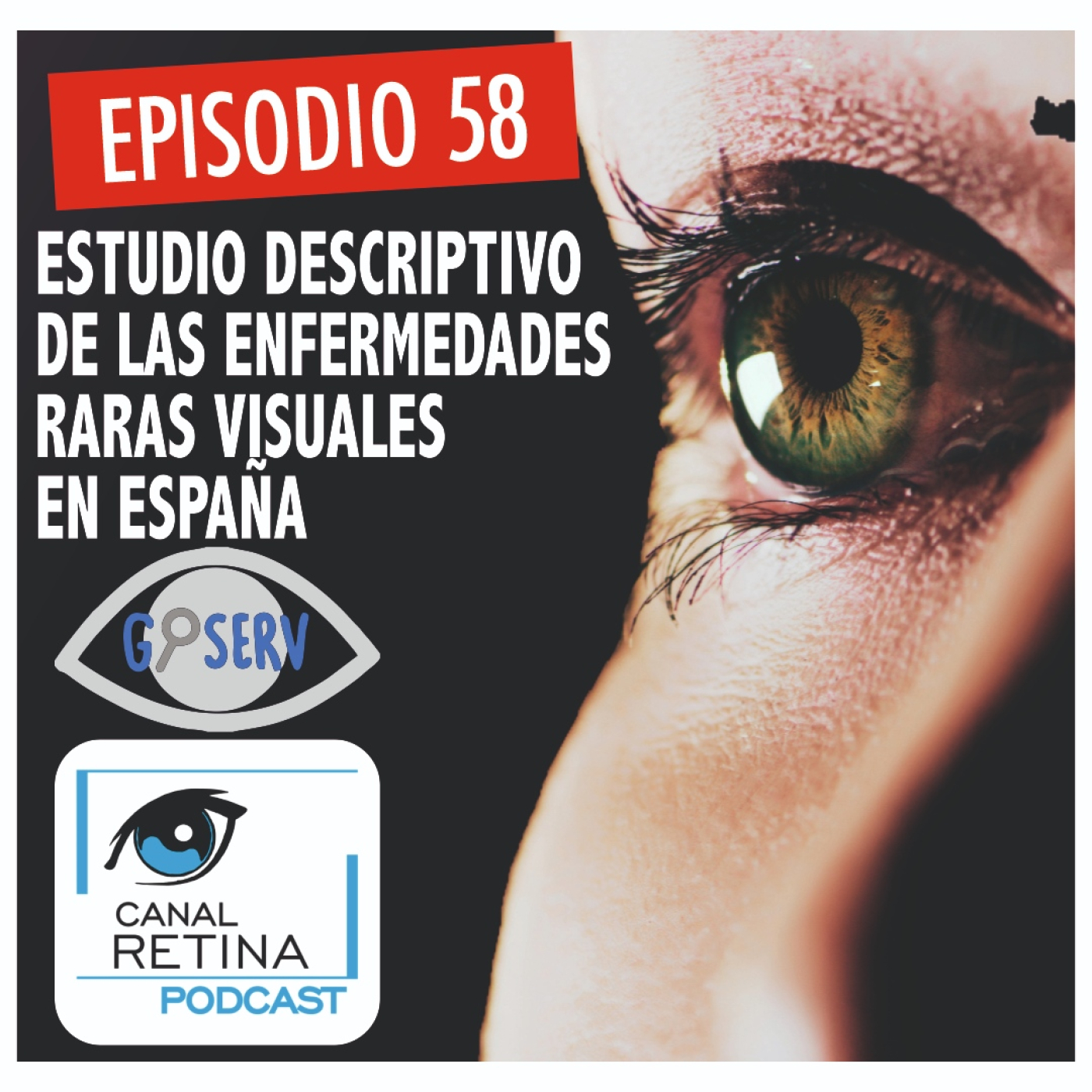 Canal Retina