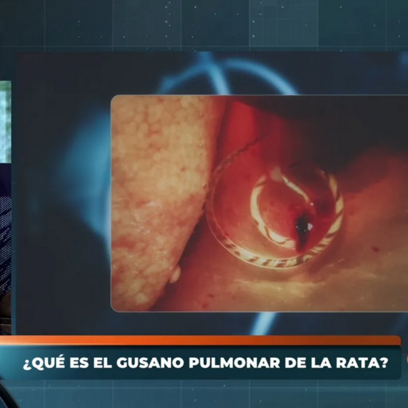 Horizonte: Alerta por las plagas de ratas