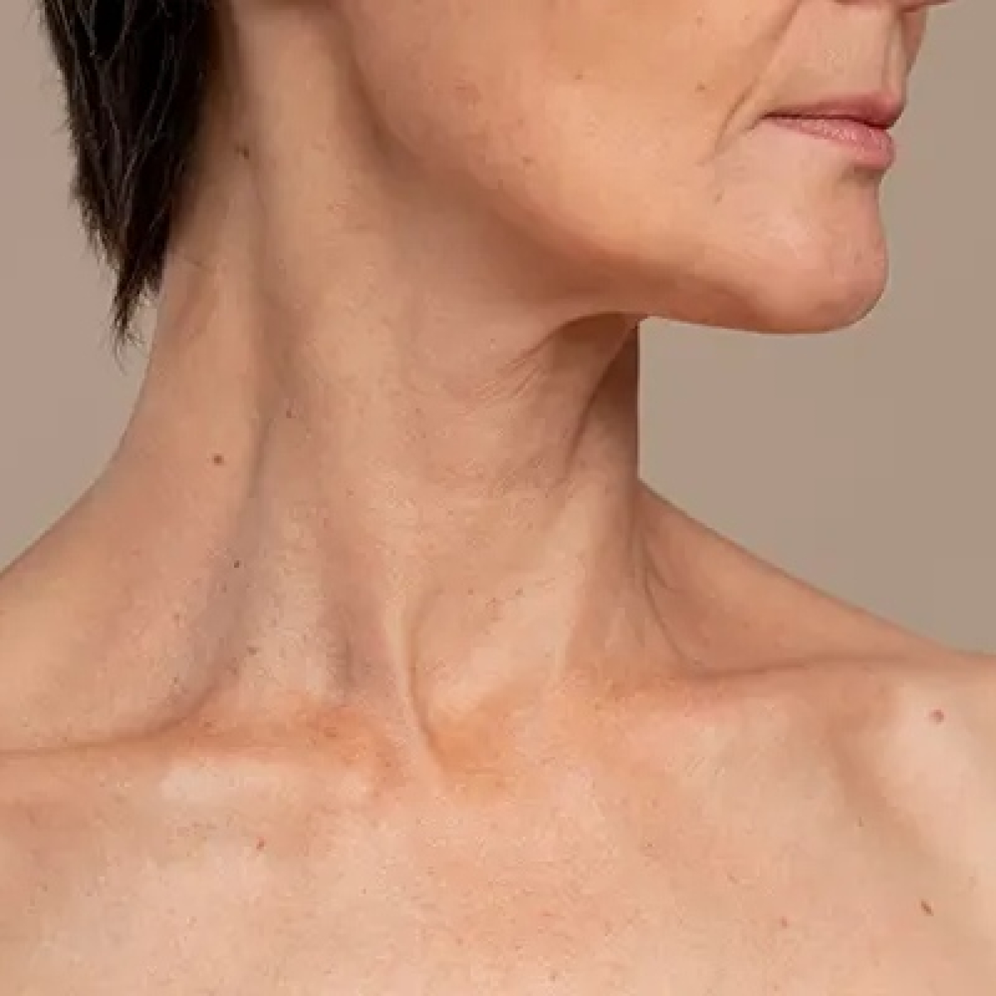 EL CUELLO NO ENGAÑA, con Dra. Helga Rivera