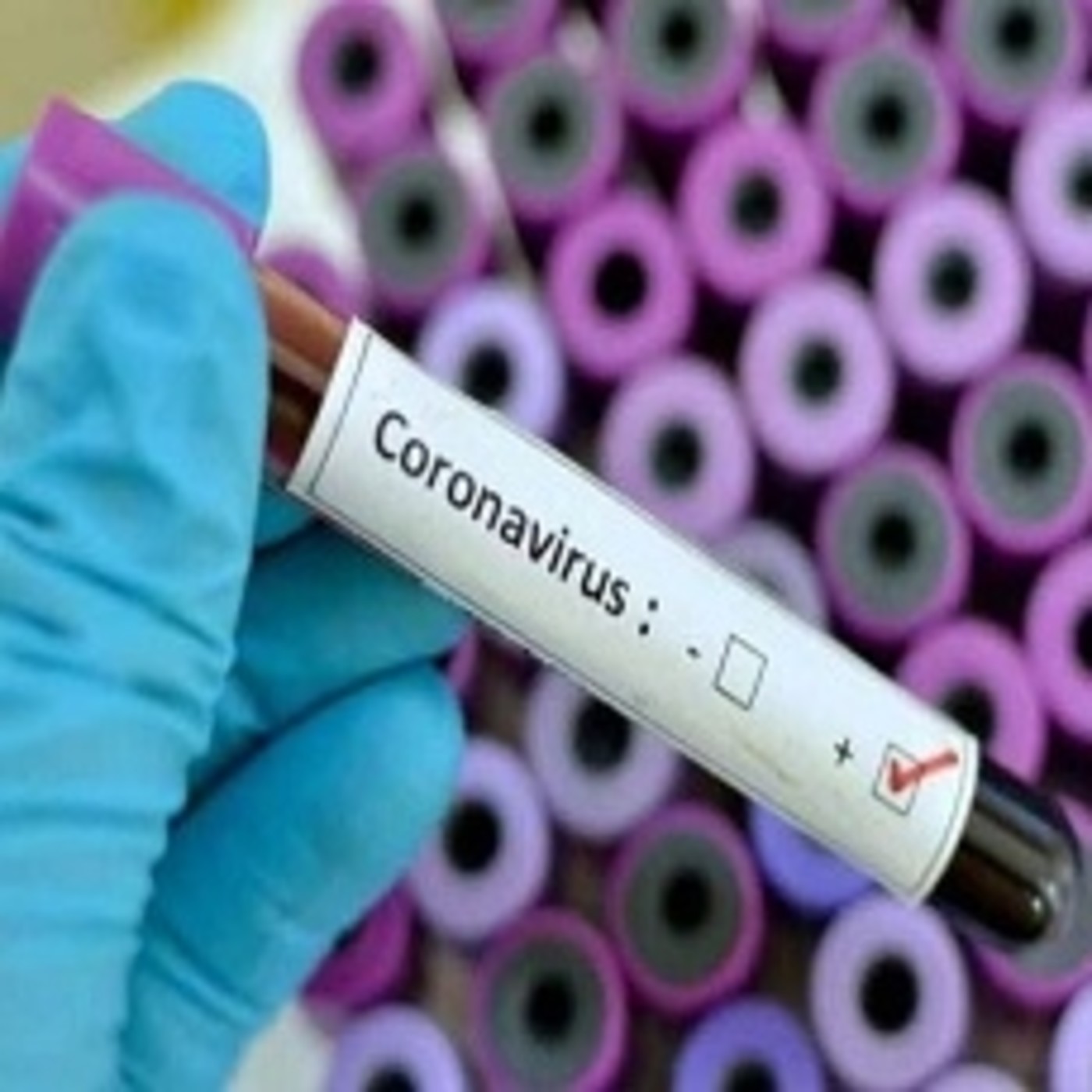 Coronavirus (COVID-19)