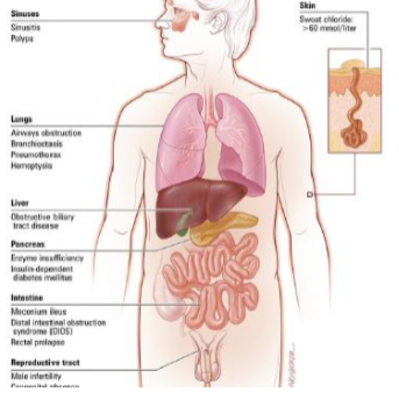 una pareja dispareja